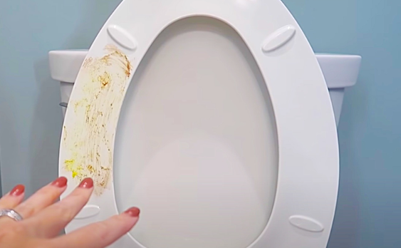 Why Did My Toilet Seat Turn Yellow After Bleaching?
