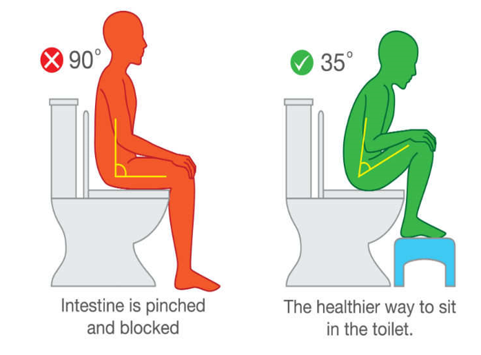 Correct Way Of Sitting On a Toilet (35 Degree Squat Poison)