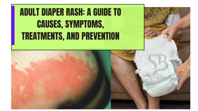 Adult Diaper Rash: Causes, Symptoms, Treatments, And Prevention