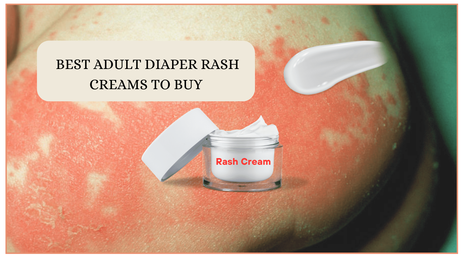Best Adult Diaper Rash Creams to Buy